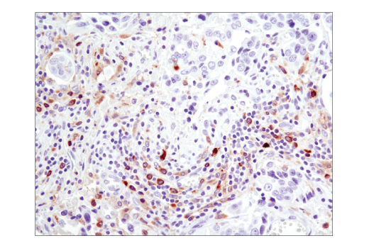 Immunohistochemistry Image 3: Btk (D3H5) Rabbit mAb (BSA and Azide Free)