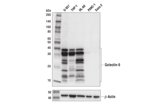 Western Blotting Image 1: Galectin-9 (D9R4A) XP<sup>®</sup> Rabbit mAb (BSA and Azide Free)