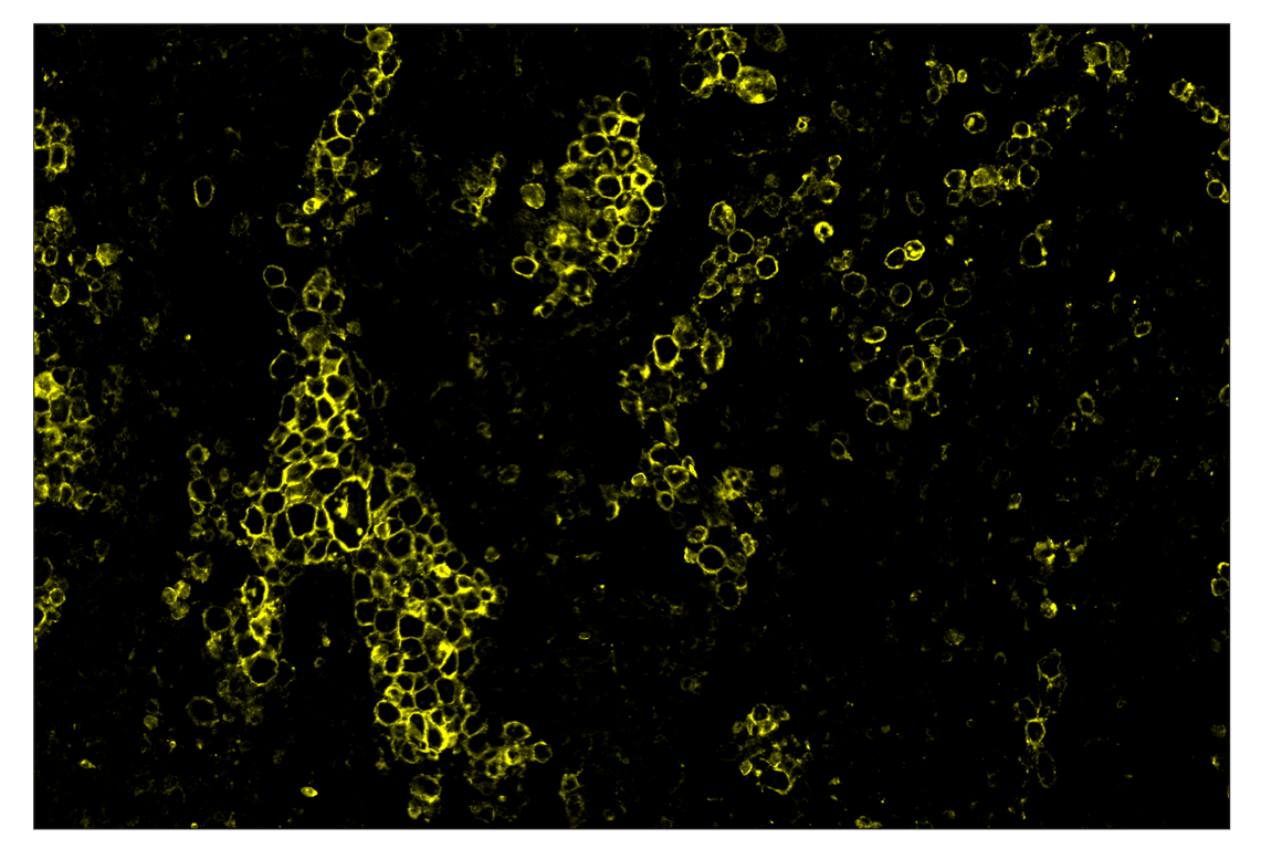 Immunohistochemistry Image 3: CD86 (E2G8P) & CO-0038-594 SignalStar<sup>™</sup> Oligo-Antibody Pair