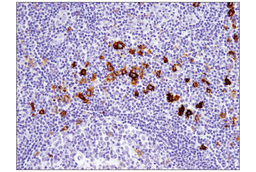 Immunohistochemistry Image 2: TNFRSF8/CD30 (E4L4I) XP<sup>®</sup> Rabbit mAb