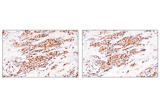 Immunohistochemistry Image 2: Cyclin D1 (E3P5S) XP<sup>®</sup> Rabbit mAb