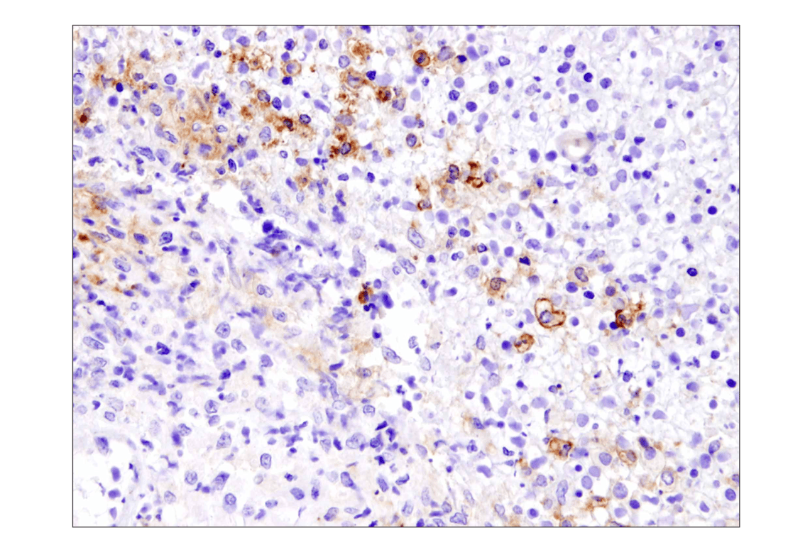 Immunohistochemistry Image 1: PD-L1 (Extracellular Domain Specific) (E1J2J<sup>™</sup>) Rabbit mAb (BSA and Azide Free)