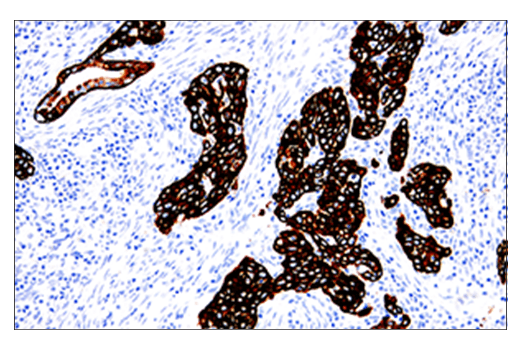 Immunohistochemistry Image 1: Keratin 5 (E2T4B) XP<sup>®</sup> Rabbit mAb