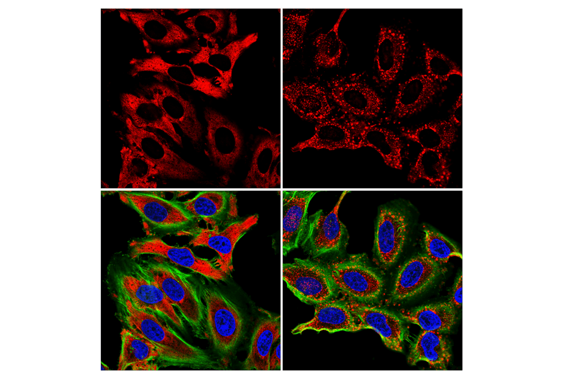 Immunofluorescence Image 1: G3BP1 (E9G1M) XP<sup>®</sup> Rabbit mAb (Alexa Fluor<sup>®</sup> 555 Conjugate)