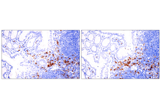 Immunohistochemistry Image 4: IL-2Rα/CD25 (E9W2J) XP<sup>®</sup> Rabbit mAb