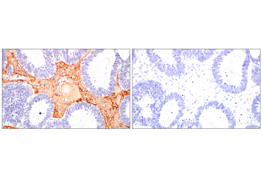 Immunohistochemistry Image 3: COL3A1 (E8D7R) XP<sup>®</sup> Rabbit mAb (BSA and Azide Free)