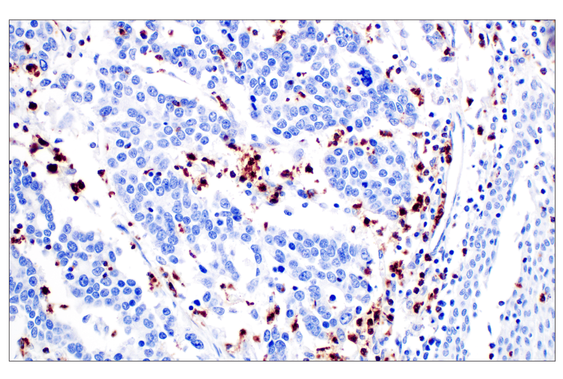 Immunohistochemistry Image 4: NKG7 (F4V5I) Rabbit mAb (BSA and Azide Free)