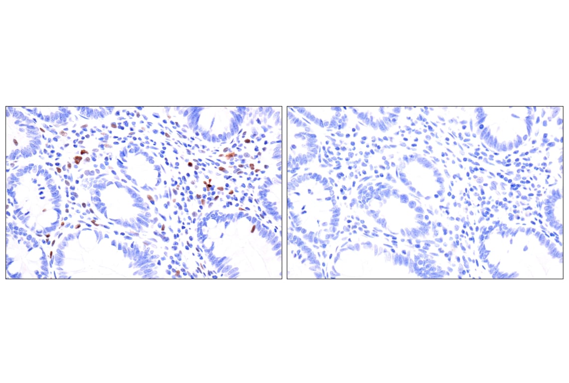 Immunohistochemistry Image 11: BATF3 (E3F3L) Rabbit mAb