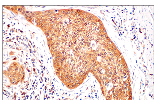 Immunohistochemistry Image 2: c-Rel (E8Z5Y) XP<sup>®</sup> Rabbit mAb (BSA and Azide Free)