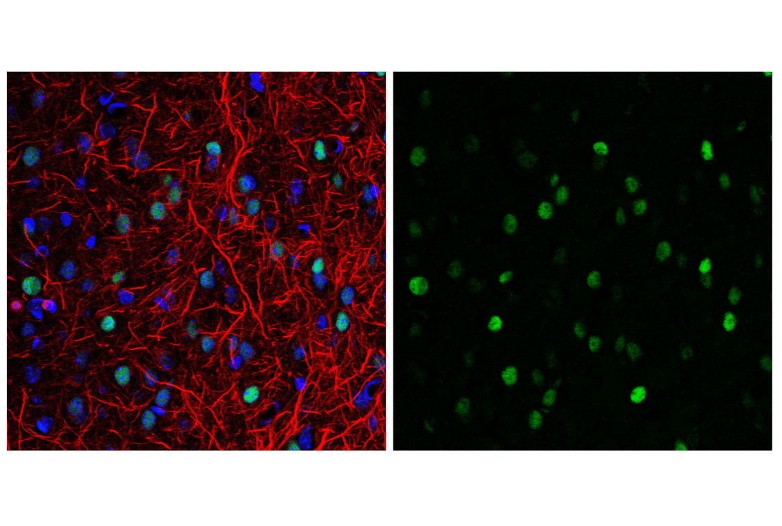 Immunofluorescence Image 1: c-Fos (9F6) Rabbit mAb