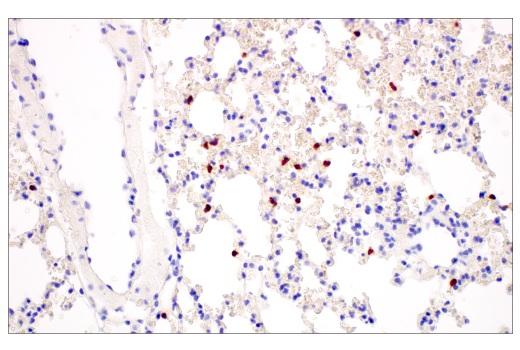 Immunohistochemistry Image 4: CD177 (E1V7N) Rabbit mAb