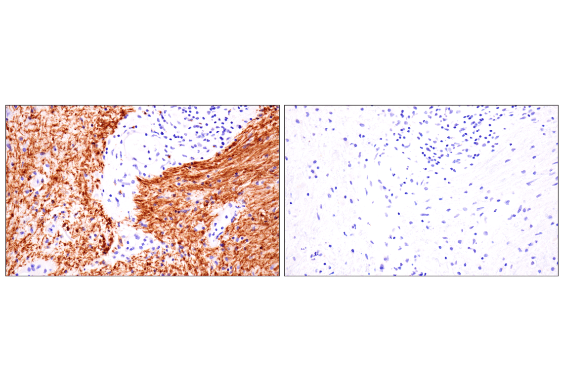 undefined Image 29: Demyelinating Disease Targets Antibody Sampler Kit