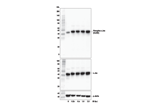 Western Blotting Image 2: Phospho-c-Jun (Ser63) (E6I7P) XP<sup>®</sup> Rabbit mAb