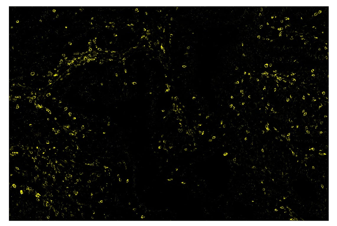 Immunohistochemistry Image 3: TIM-3 (D5D5R<sup>™</sup>) & CO-0010-647 SignalStar<sup>™</sup> Oligo-Antibody Pair