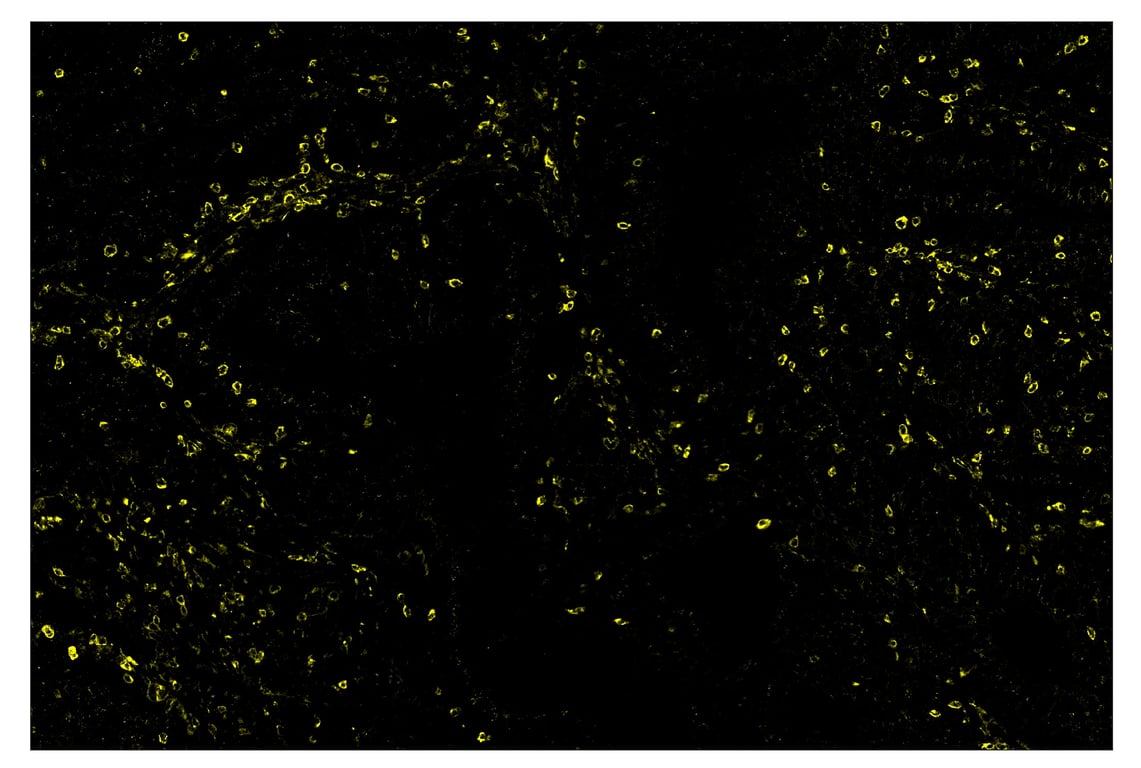 Immunohistochemistry Image 3: TIM-3 (D5D5R<sup>™</sup>) & CO-0010-594 SignalStar<sup>™</sup> Oligo-Antibody Pair