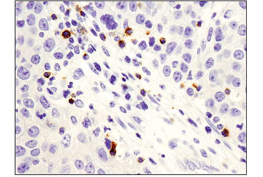 Immunohistochemistry Image 1: LAG3 (D2G4O<sup>™</sup>) XP<sup>®</sup> Rabbit mAb (BSA and Azide Free)