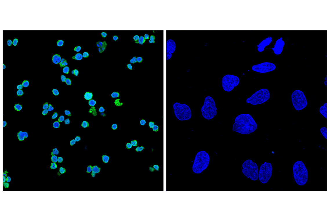 Immunofluorescence Image 1: Myeloperoxidase (E2Z8J) Rabbit mAb