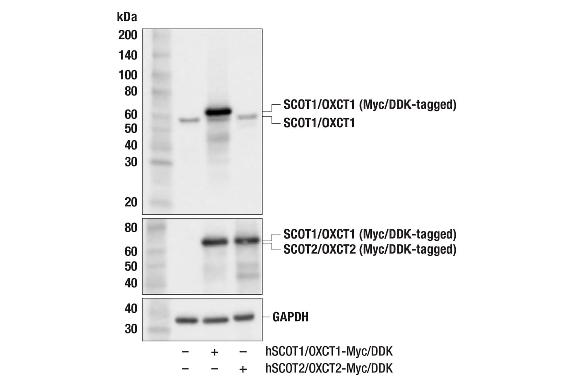 Western Blotting Image 3: SCOT1/OXCT1 (F1O1D) Rabbit mAb