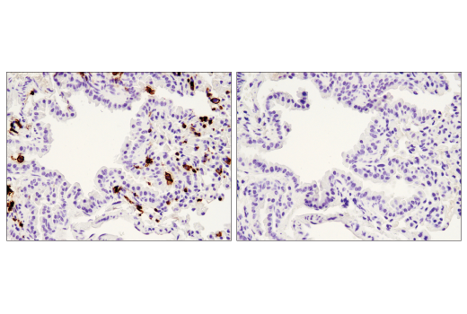 Immunohistochemistry Image 4: CD45 (D3F8Q) Rabbit mAb (BSA and Azide Free)