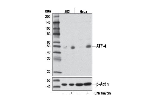 Western Blotting Image 1: ATF-4 (D4B8) Rabbit mAb