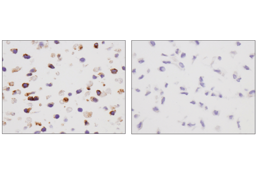 Immunohistochemistry Image 3: VISTA (D5L5T) XP<sup>®</sup> Rabbit mAb