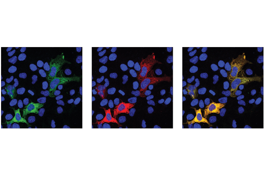 undefined Image 4: Cas9 and Associated Proteins Antibody Sampler Kit