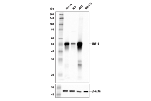 Western Blotting Image 3: IRF-4 (E8H3S) XP<sup>®</sup> Rabbit mAb (BSA and Azide Free)