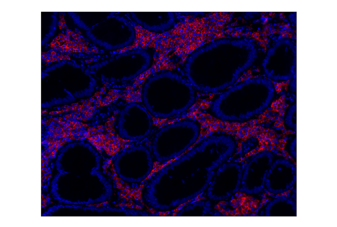 Immunohistochemistry Image 2: CD38 (E7Z8C) XP<sup>®</sup> Rabbit mAb (Alexa Fluor<sup>®</sup> 555 Conjugate)