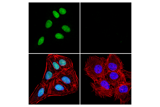 undefined Image 12: Fanconi Anemia Antibody Sampler Kit