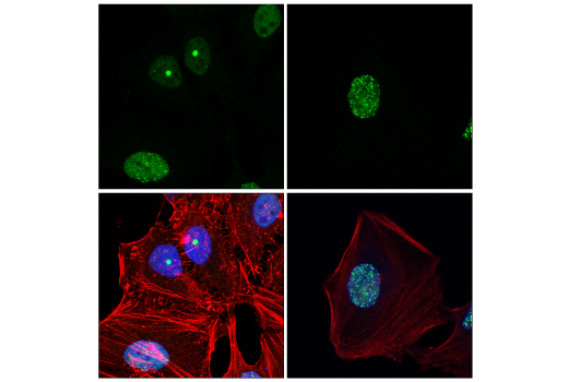 Immunofluorescence Image 2: 53BP1 (E7N5D) XP<sup>®</sup> Rabbit mAb (BSA and Azide Free)