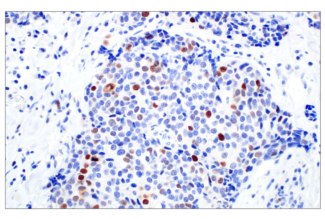 Immunohistochemistry Image 1: BRCA1 (E5S9G) Rabbit mAb