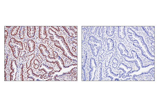 Immunohistochemistry Image 1: SS18 (D6I4Z) Rabbit mAb (BSA and Azide Free)