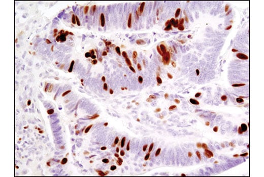 Immunohistochemistry Image 1: Phospho-Rb (Ser807/811) (D20B12) XP<sup>®</sup> Rabbit mAb