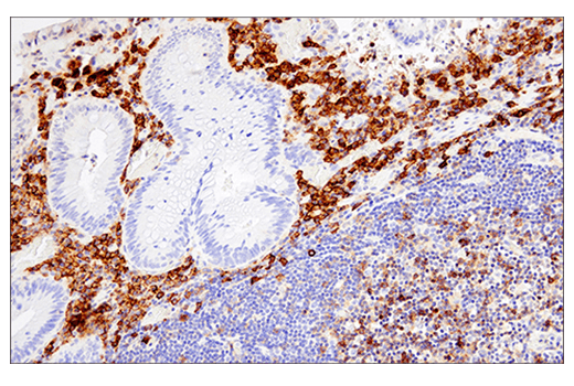 Immunohistochemistry Image 2: CD38 (E7Z8C) XP<sup>®</sup> Rabbit mAb