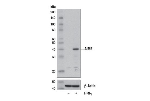 undefined Image 13: Human Reactive Inflammasome Antibody Sampler Kit II