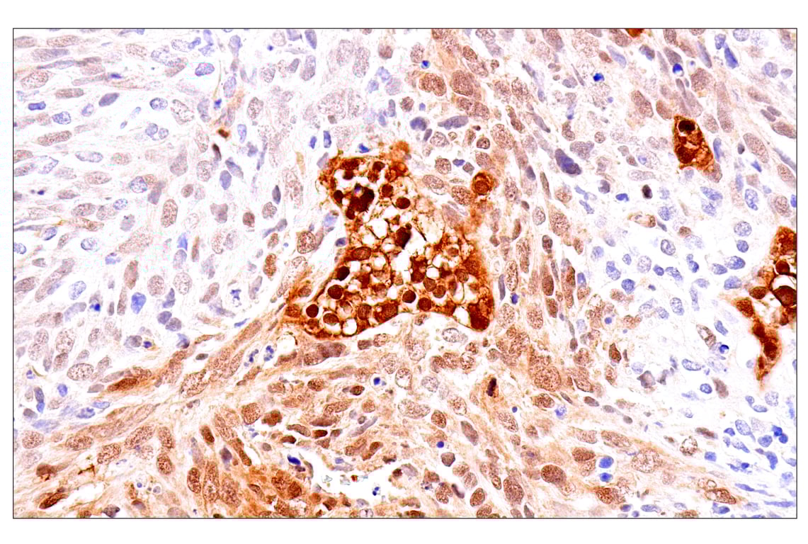 Immunohistochemistry Image 6: Phospho-YAP (Ser61) (E4Q8S) Rabbit mAb