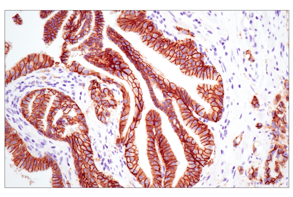 undefined Image 7: Cadherin-Catenin Antibody Sampler Kit