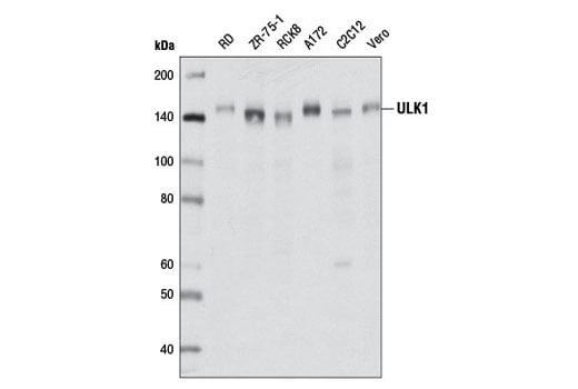 undefined Image 4: PhosphoPlus<sup>®</sup> ULK1 (Ser757) Antibody Duet