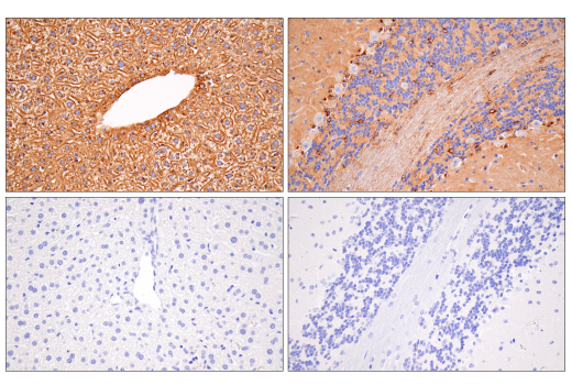undefined Image 30: Late-Onset Alzheimer's Disease Risk Gene (Mouse Model) Antibody Sampler Kit