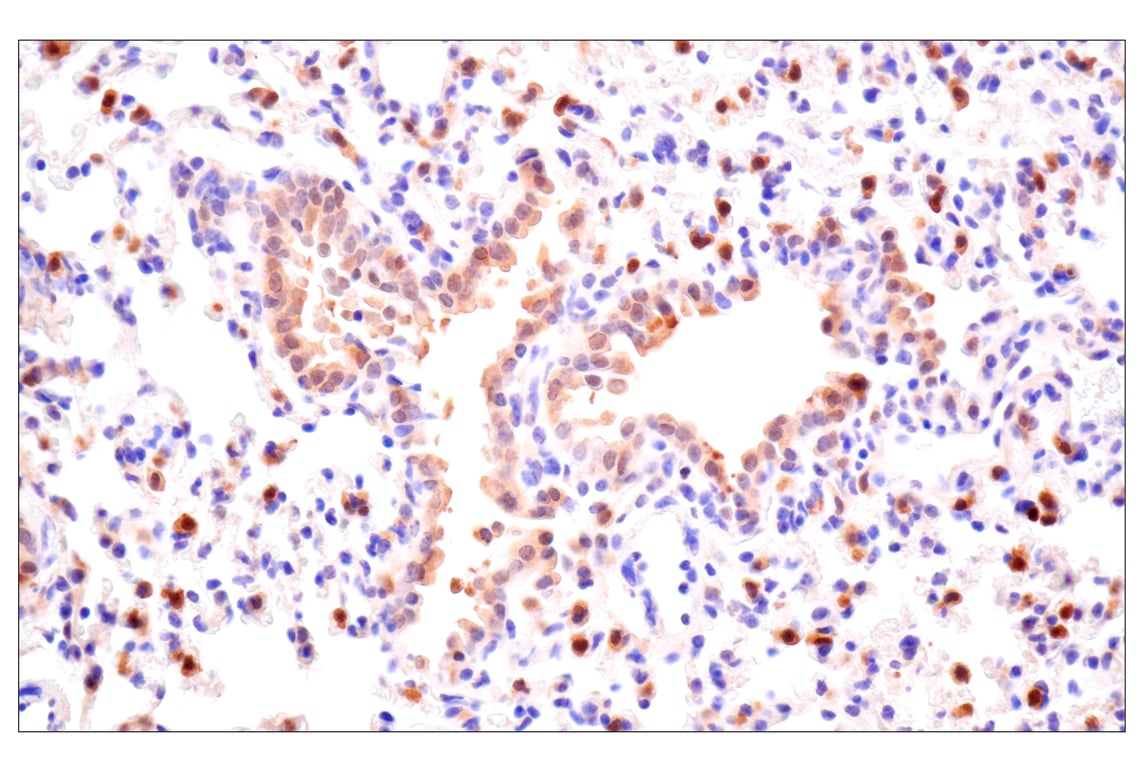 Immunohistochemistry Image 11: ACBP/DBI (E4V8V) XP<sup>®</sup> Rabbit mAb