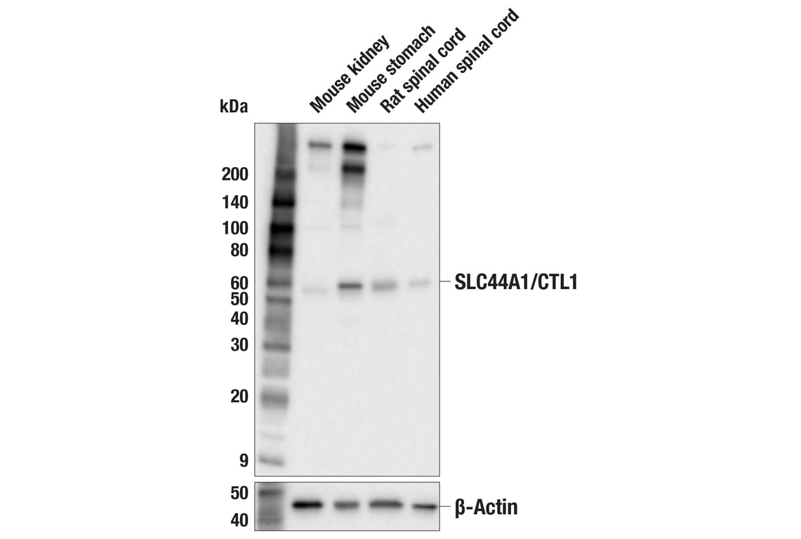 Western Blotting Image 1: SLC44A1 (F8D3V) Rabbit mAb