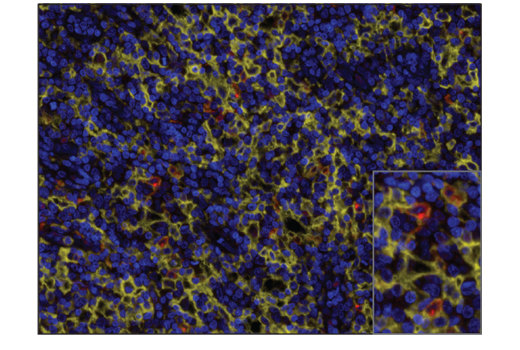 Immunohistochemistry Image 1: XCR1 (D2F8T) Rabbit mAb