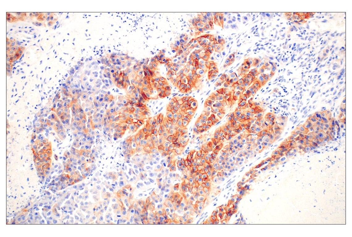 undefined Image 33: Lung Cancer RTK Antibody Sampler Kit