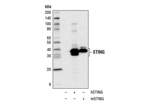 Western Blotting Image 2: STING (D2P2F) Rabbit mAb