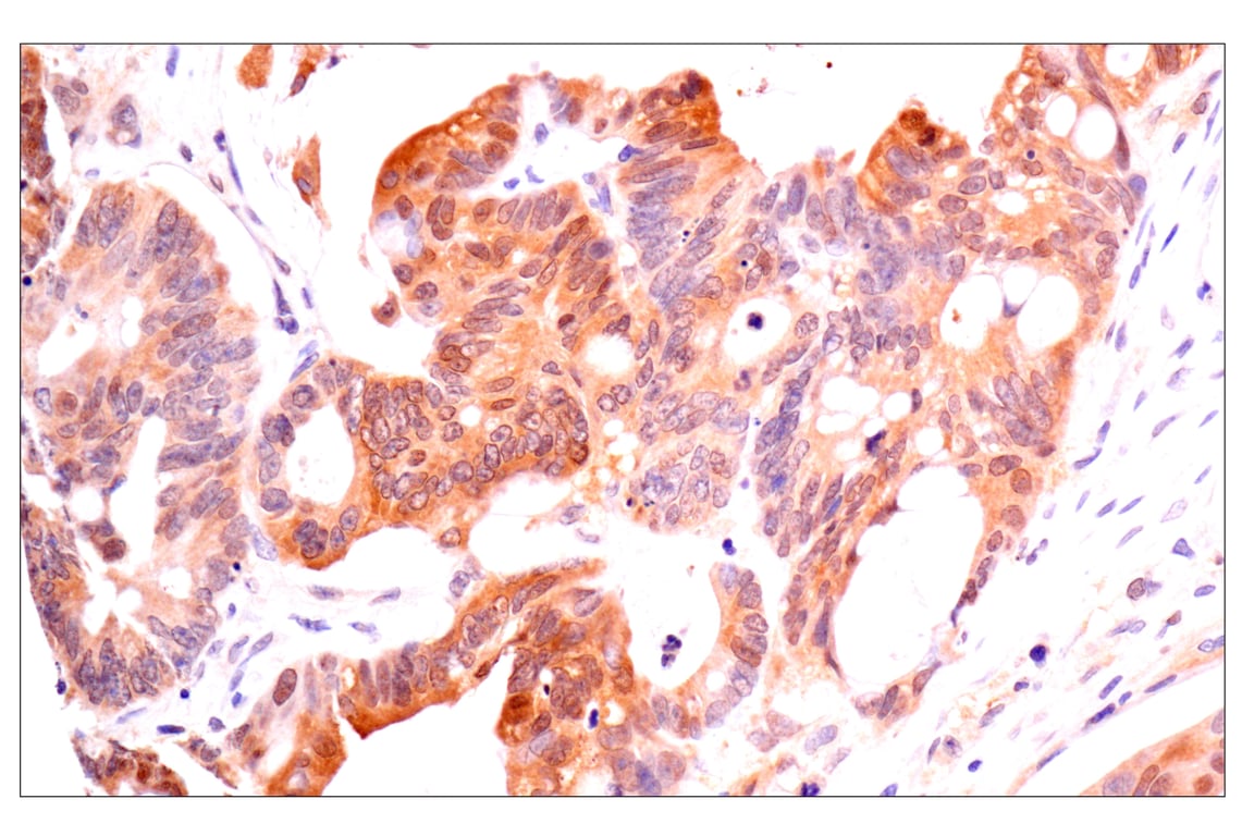 Immunohistochemistry Image 3: ACBP/DBI (E4V8V) XP<sup>®</sup> Rabbit mAb