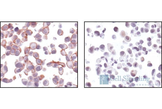 Immunohistochemistry Image 3: Phospho-Akt (Ser473) (736E11) Rabbit mAb