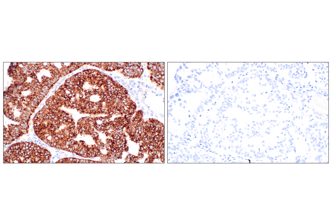 undefined Image 54: Cell Fractionation Antibody Sampler Kit