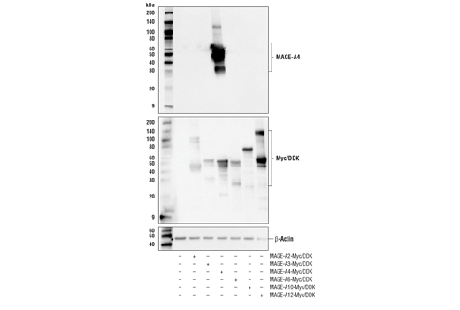 Western Blotting Image 2: MAGE-A4 (E7O1U) XP<sup>®</sup> Rabbit mAb