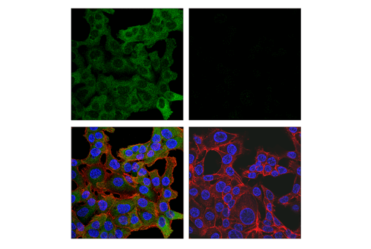 undefined Image 33: Xenophagy Antibody Sampler Kit