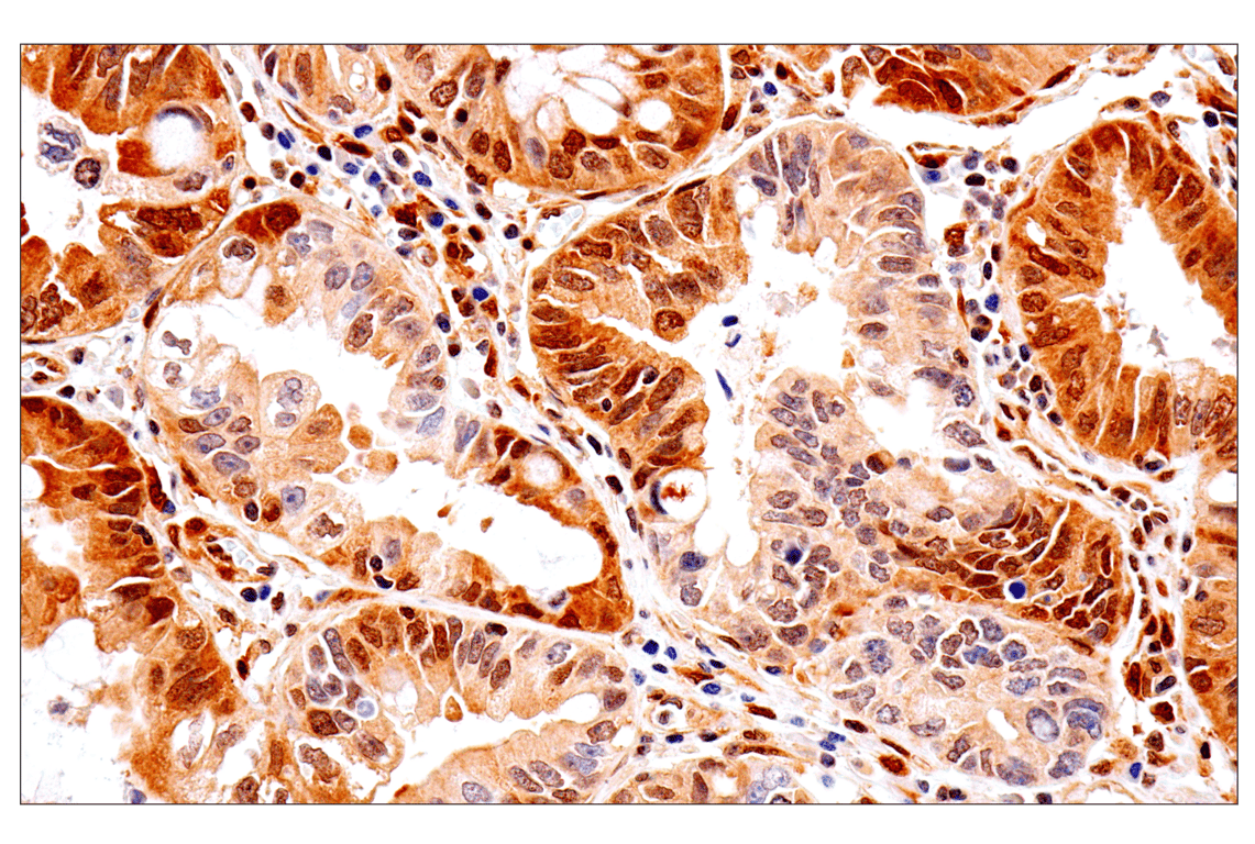 Immunohistochemistry Image 1: PTEN (D4.3) XP<sup>®</sup> Rabbit mAb (BSA and Azide Free)